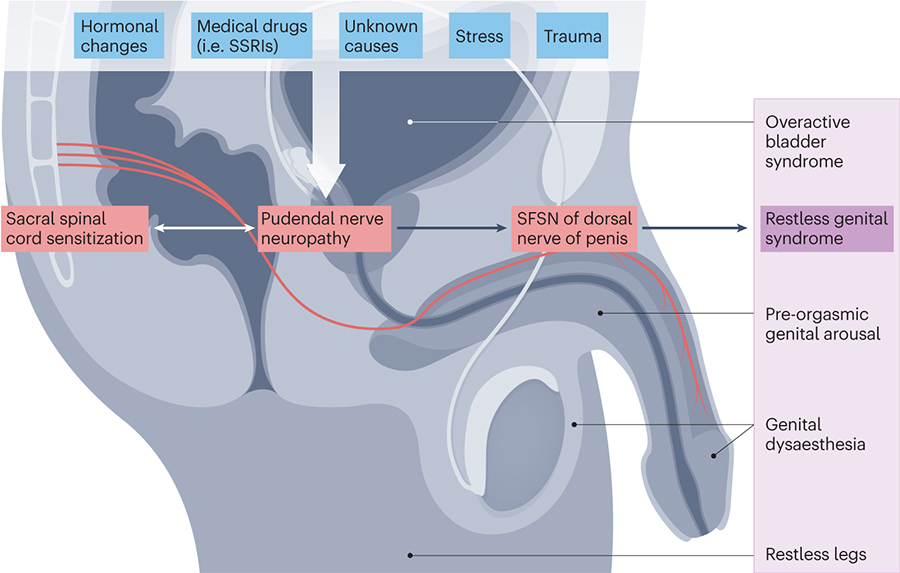 1767427675428536.jpg ED-與早洩為何常同時出現.jpg